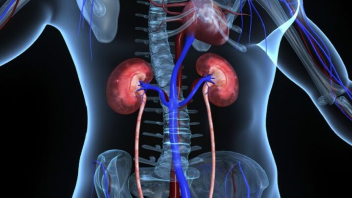 End-Stage Renal Disease: Causes And Symptoms - SuccessYeti