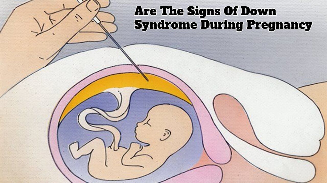 the-causes-of-down-syndrome-during-pregnancy-and-how-to-test-for-it