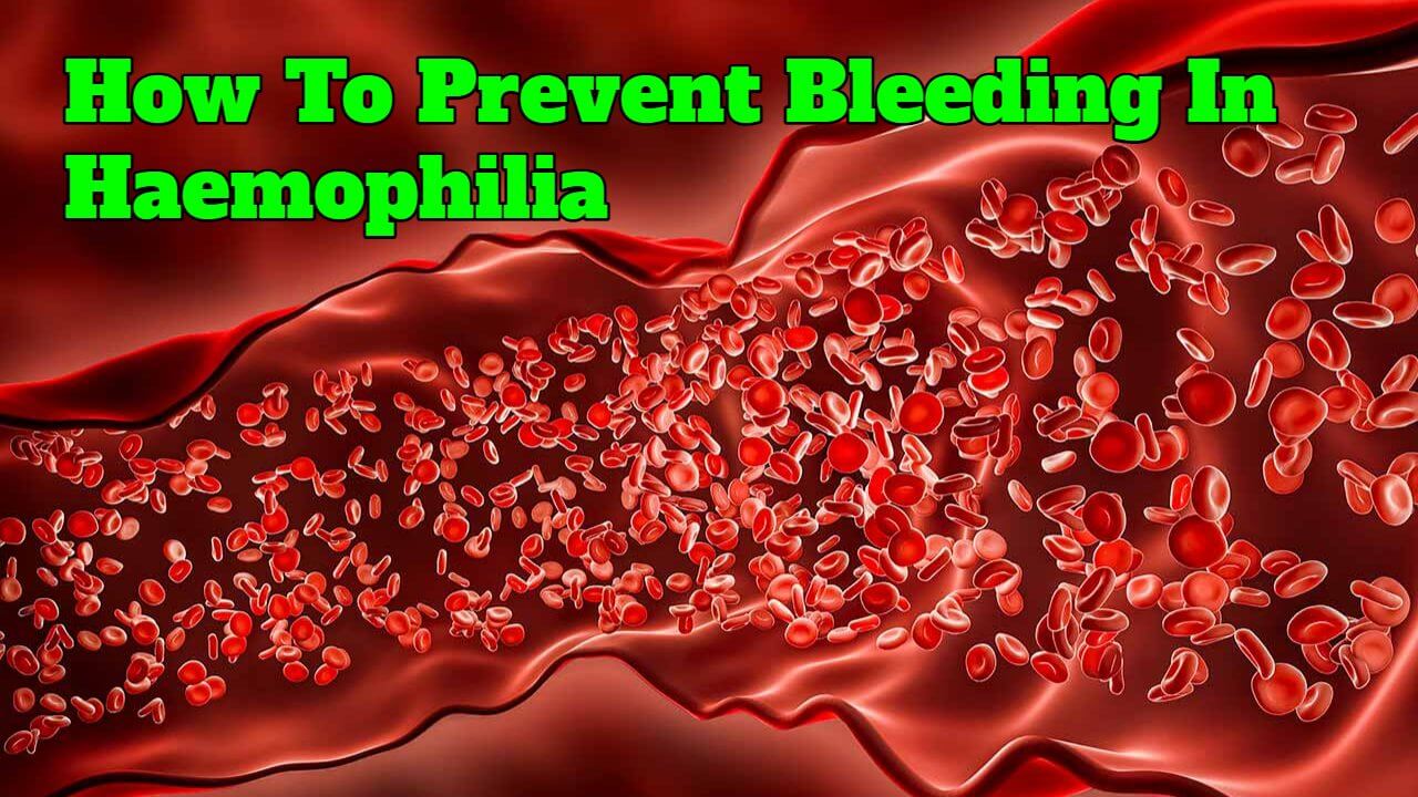 How To Prevent Bleeding In Haemophilia - SuccessYeti